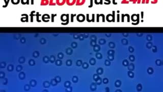 🔴 GROUNDING TO EARTH STOPS BLOODCLOTS - INFLAMMATION & PAIN