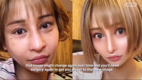 Documentary: Down Sides of Plastic Surgery