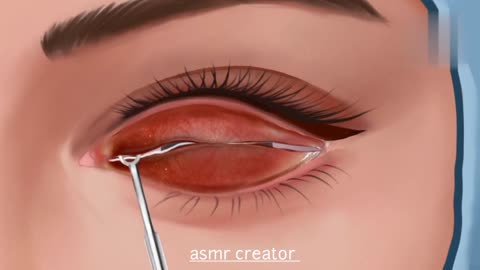 Asmr eyes treatment animation asmranimation video