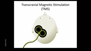 HMS CENTRE FOR BIOETHICS: Hacking the Brain: Neuroenhancement with Noninvasive Brain Stimulation (2015)