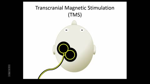 HMS CENTRE FOR BIOETHICS: Hacking the Brain: Neuroenhancement with Noninvasive Brain Stimulation (2015)