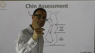 Chin Assessment - Assessing The Chin By Dr Mike Mew