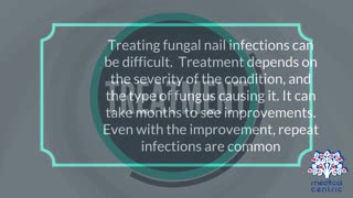 Fungal Nail Infection, Causes, Signs and Symptoms, Diagnosis and Treatment.