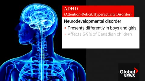 Social media behind uptick in ADHD assessments in Canada psychologists