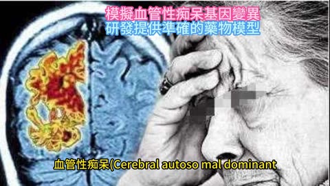 模擬血管性痴呆基因變異 研發提供準確的藥物模型