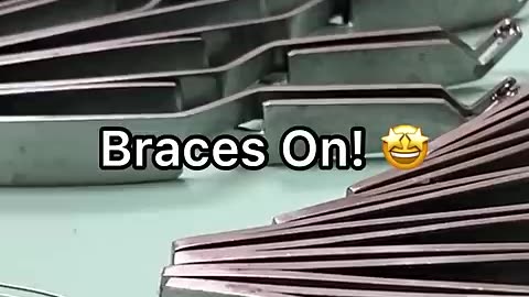 How braces are put on Tooth Time