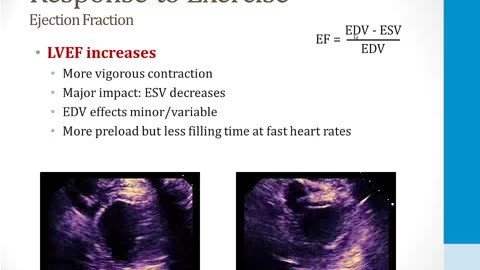 Cardiology - 1. Anatomy and Physiology - 3.CV Response to Exercise