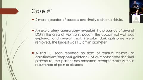 No. 21. Dropped Gallstones