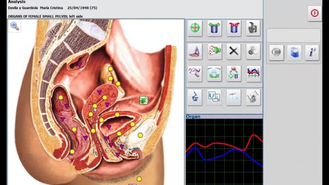 Sistema de escaneo de la salud NLS