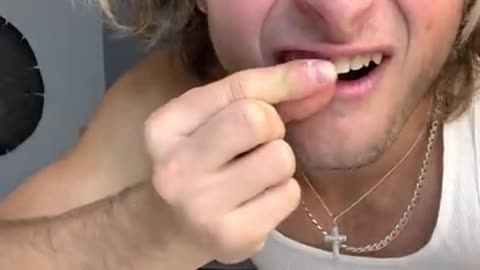 TOPPER GUILD LOSES TOOTH PRANK - #Shorts