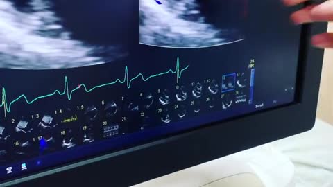 Echographe cardiovasculaire de Florian Dagoury à l’hôpital de Bangkok en Thaïlande