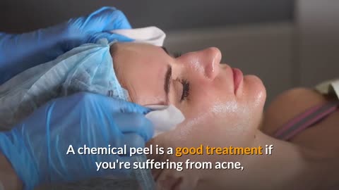 Chemical Peel Treatments For Smooth, Unblemished, Younger Looking Skin