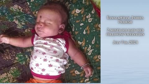 2 month old baby died following vaccination