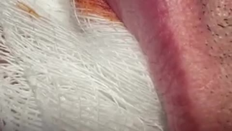 Worm in the lip