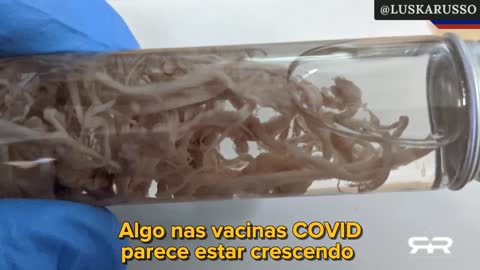 Bio-Estruturas Maciças Encontradas Nos Corpos Dos Vacinados. 🇺🇸 InfoWars | Greg Reese