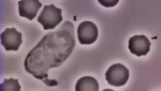 This video shows a human white blood cell chasing a bacterium