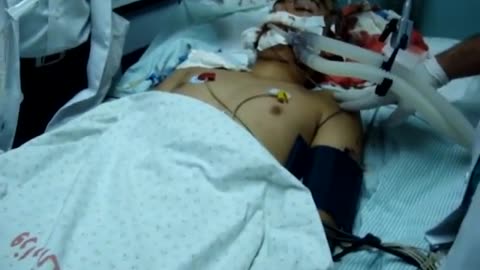 Shifa Hospital: Palestinians critically injured by Israeli bombings in December 2008, Gaza