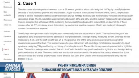 Organ Transplants From Babies to Adults in China Raises Concerns, Expert Warns