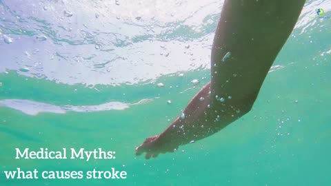 Medical Myths: what causes stroke