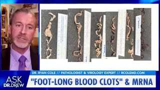 Dr. Ryan Cole Explains How To Clear Strange Clots From The Body