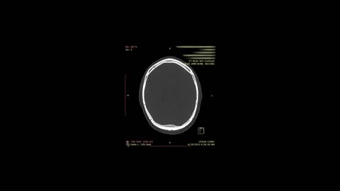 Scanning cat skull medical anatomy