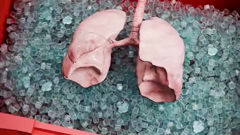 How donor lungs are kept fresh?🤔
