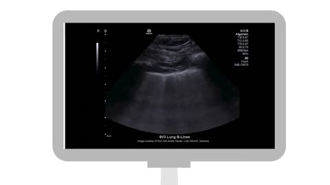 Ultrasound Explained: How Does it Work?