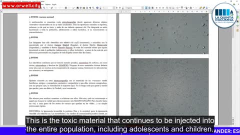 COVID vaccine microphotographs by Salvador Pérez Martín: Graphene-derived structures