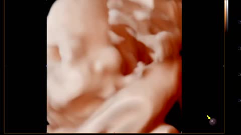 Ultrasonic video of a yawning baby.