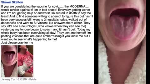 ( -0022 ) Shawn Skelton - (Bizzare Unfortunate Side Effects Of COVID-19 Moderna Vaccine, 7th January 2021)