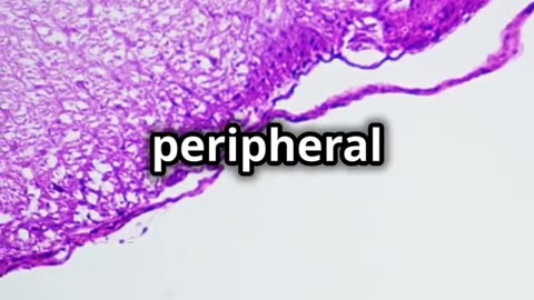 What is Neuropathy: Understanding Peripheral Neuropathy #neuropathy #neuropathytreatment