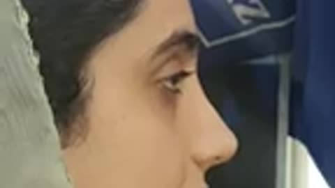 A girl with perfect nose before & after surgery