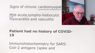 mRNA Covid Vaccine Caused Brain Injury - presented by Dr John Campbell (Feb 2023)