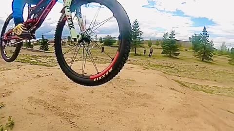 Sherwood Park Dirt Jumps: Strathcona County Bike Skills Park