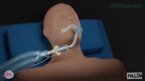 Basics of ventilation_ Deadspace in breathing
