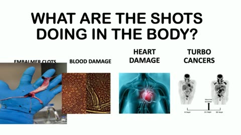 Old but Relevant News - Covid Injection Poisoning