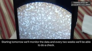 Microscopic analysis of a drop of blood from a person "vaccinated" with Sinopharm