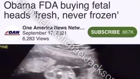 Documents On 👉Obama FDA buying 🤬fetal heads "fresh” never frozen" DARK TO LIGHT”