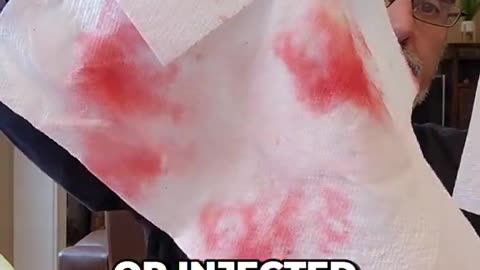 Another Video On Chemically Injected Watermelons