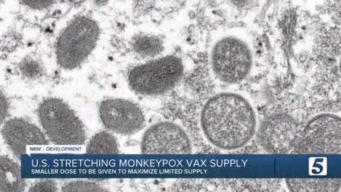 Plans reportedly in the works to stretch monkeypox vaccine supply in the US