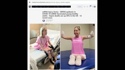 Sherri Moody the teacher whose limbs were amputated after Contracting Sepsis