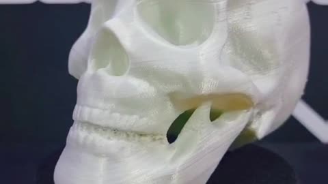 Skeleton 3D prinring