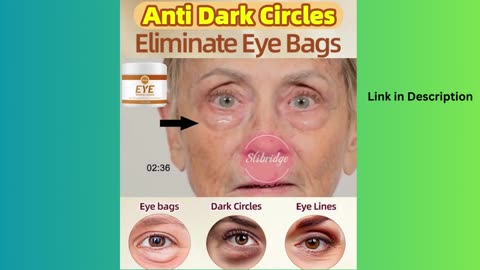Dark circles cream and eye bags removal puffiness away work under eyes.