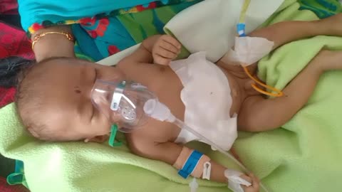 Help Baby Get A Second Chance At Life / This Baby Is Battling Between Life And Death