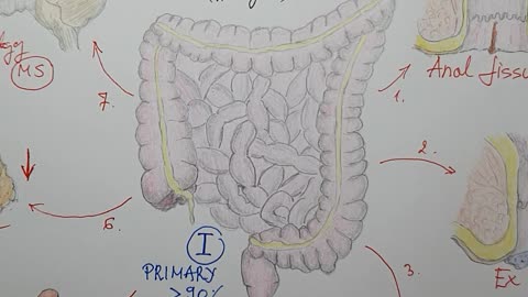 CONSTIPATION HEALTH Tips constipation treatment 1stmedical