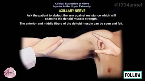 axillary nerve injury, causes, symptoms, diagnosis and treatment. deltoid muscle weakness.