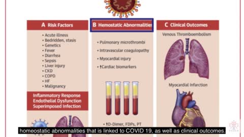 Dr Rochagne Kilian elevated D-Dimer in COVID vaccinated - WHISTLEBLOWERS