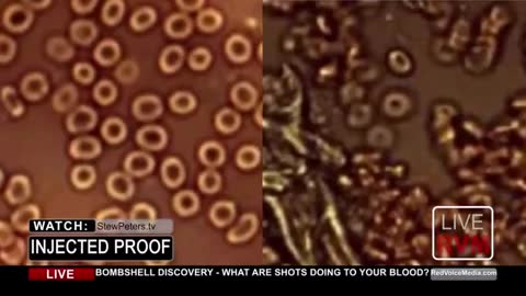 Dr.Jane Ruby: INJECTED PROOF !!! WHAT ARE SHOTS DOING TO YOUR BLOOD??? BOMBSHELL !!!