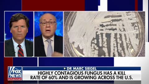 Tucker: The CDC Warns of a Contagious Fungus With Up to a 30 to 60% Kill Rate