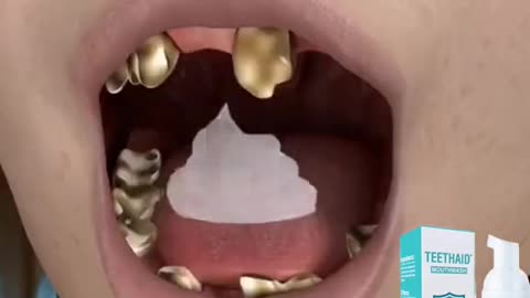 deep cleaning teeth